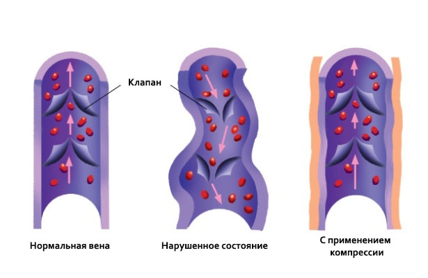 Экипировка: Компрессионная одежда - разбор мифов, плюсов и минусов